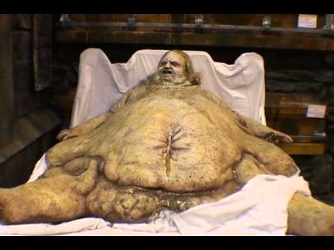 Fatty pics images 8
