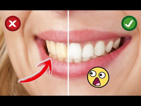 Remedios caseros para aclarar los dientes rapido