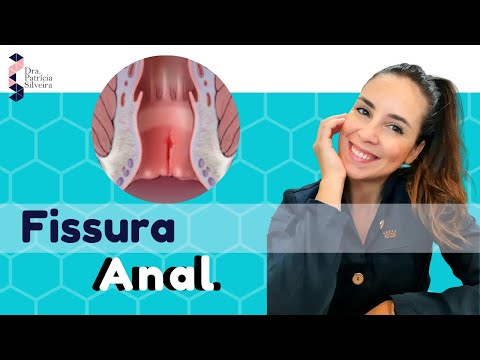 Vídeo: Fissura Anal - Tratamento, Cirurgia, Sintomas