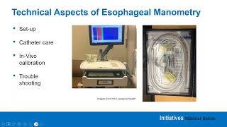 Elevating Esophageal Manometry  Incorporating of Chicago 4 0 Protocol