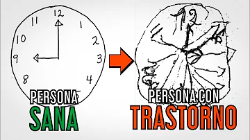 ¿Por qué las personas con demencia no pueden dibujar un reloj?