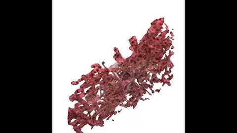 Two-photon vessel rendering