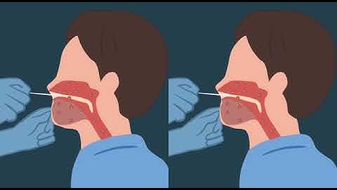 iGEM Stanford University - PROJECT