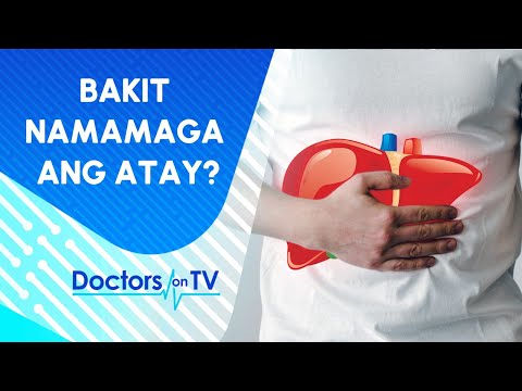 Pagkakaroon ng taba sa atay o Fatty Liver, may paraan ba para maiwasan?