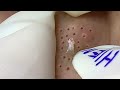 Satisfying Hien Spa Beauty Relaxing Video #18