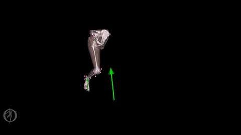 Personalised model of child with cerebral palsy walking