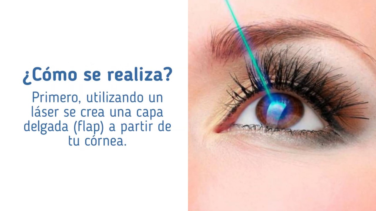 ¿Qué es el procedimiento Lasik? - YouTube
