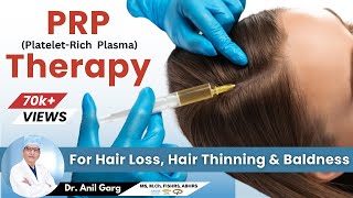 PRP Therapy | PRP Treatment for Hair Loss | PRP Side Effects | PRP Results