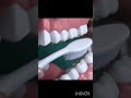 #brushing technique#gaurdentalclinic#smile#prosthodontist