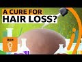 Why is there no cure for hair loss? | BBC Ideas