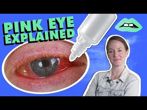 What Is Pink Eye And How Do You Treat It?