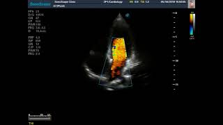 SonoScape 2P1 pair with S11Plus regular clinical image