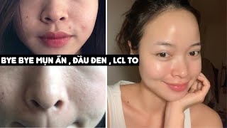 3 SẢN PHẨM THỰC SỰ KHIỂN DA BẠN ĐẸP LÊN MỖI NGÀY