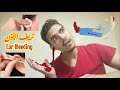 اسعافات نزيف الاذن وعلاجه أسبابه وأعراضه Ear Bleeding First Aid And Treatment Causes Symptoms 