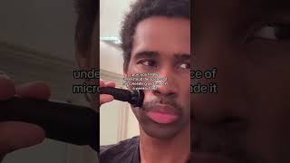 POV: You finally took microneedling seriously and results are showing #acnescars #acne #explore