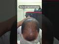 Day 28 Hair Regrowth Challenge | serum apply on scalp #hairgrowthtreatment #hairfallsolution #short