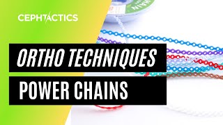 Power chain (Continuous Elastomers) in Orthodontics
