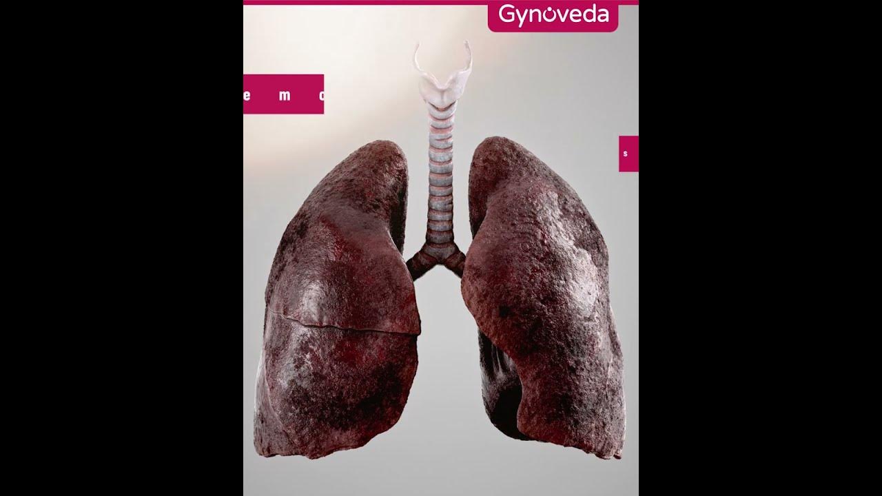 gynoveda-lung-detox-to-reduce-smoking-damage-asthma-attacks-and