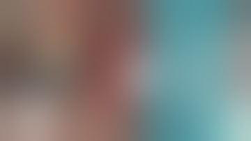 Sub Crestal Sinus Augmentation Combined with OSSIX Bone Utilizing Osseodensification. Prof Z Mazor