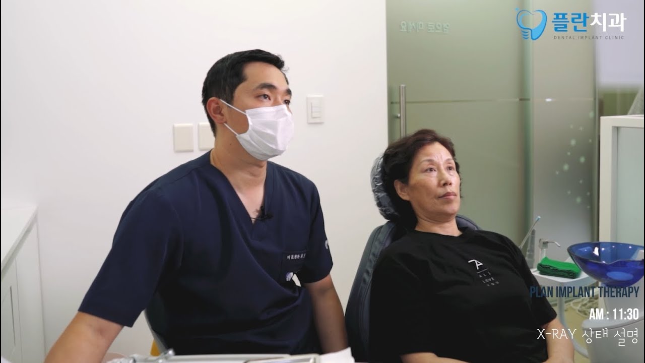 [여성 임플란트] 임플란트 14개 식립 치료 계획 상담