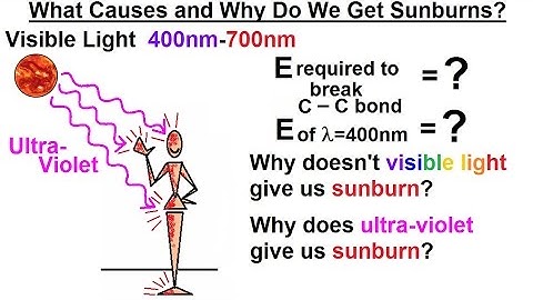 Particle Physics (38 of 41) What is a Photon? 22. UV Rays - How Do We Get Sunburns?