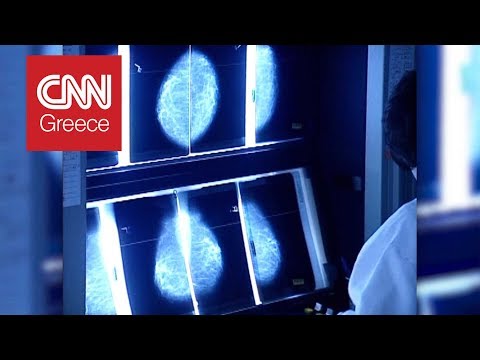 Βίντεο: Καρκίνος των κυττάρων πλάσματος στα κουνάβια