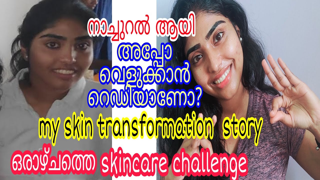 Skin Whitening Challenge Malayalam Home Remedies For Skin Whitening