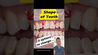 Enhance Your Smile: 3 Effective Methods For Changing Tooth Shape #dentallan #dentist #shorts