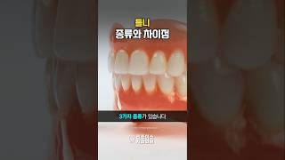 틀니, 종류별 차이 모르면 손해! 내게 맞는 선택법