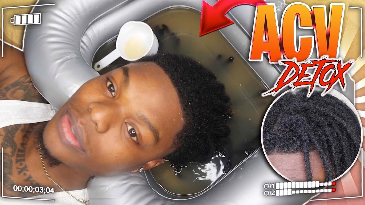 My FIRST ACV Rinse For My DREADLOCKS Hair Updates YouTube