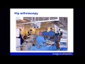D. Griffin, HAS for impaction FAI in low femoral antetorsion, Hip Symposium 2016