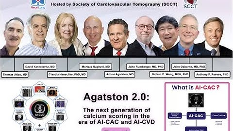 (Part 1) Agatston 2.0: The next generation of calcium scoring in the era of AI-CAC and AI-CVD