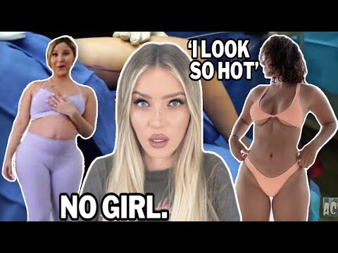 your 'mommy makeover' is a mess.