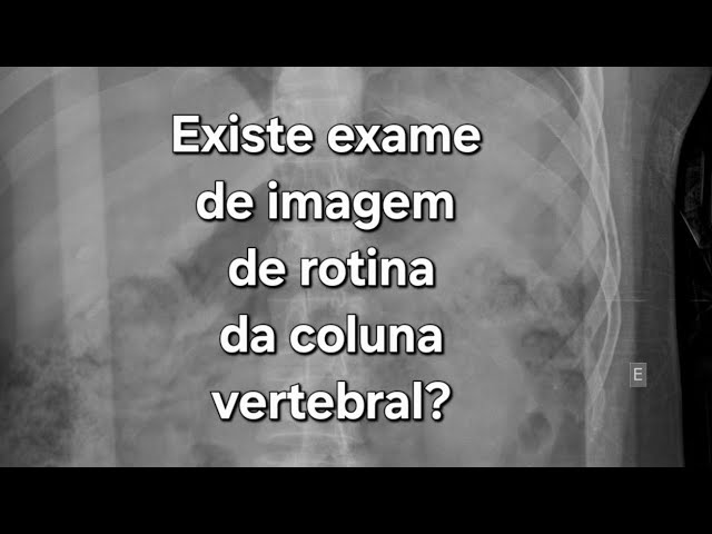 Existe exame de imagem preventivo na coluna vertebral?