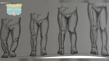 ¿Por qué mi hijo tiene rodillas valgas?