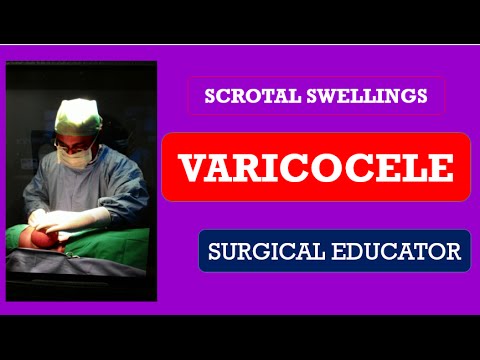 Video: Varicocele Hos Børn Og Unge - årsager, Symptomer Og Diagnose