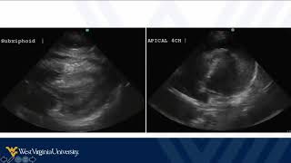 POCUS in Trauma 6 - Pitfalls and Summary