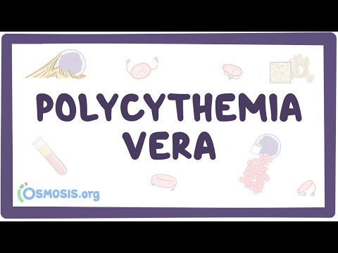 Video: Complicaties Van Polycythemia Vera: Wat Te Weten