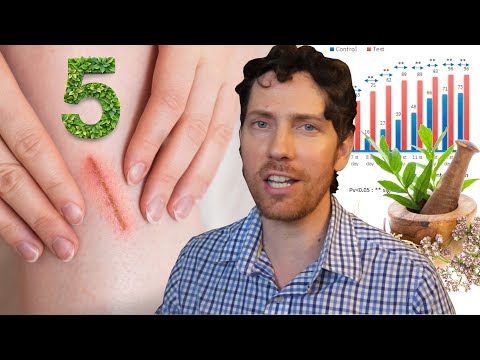 Thumbnail for Top 5 Plants for Wound Healing
