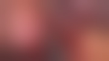 Laparoscopic Cholecystectomy with Veress needle technique - Mr Kamran Qurashi - Mr Cosimo Alex Leo