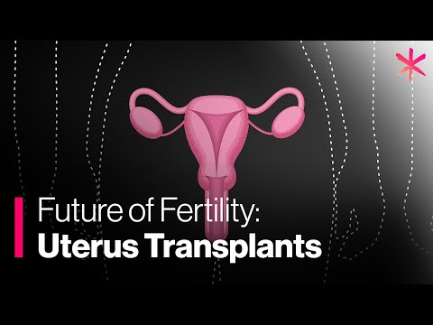 Video: In 5-10 Years, With The Help Of A Uterus Transplant, Men Will Be Able To Give Birth To Children - Alternative View
