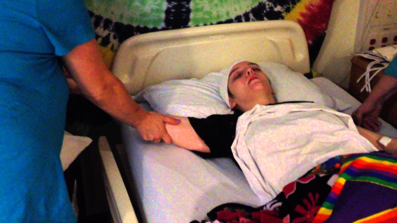 3 months after emergency craniectomies