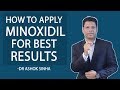 HOW TO APPLY MINOXIDIL FOR BEST RESULT - DR. ASHOK SINHA