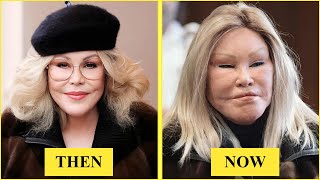 Most UNBELIEVABLE Plastic Surgery of Hollywood Celebrities I then and now 2026