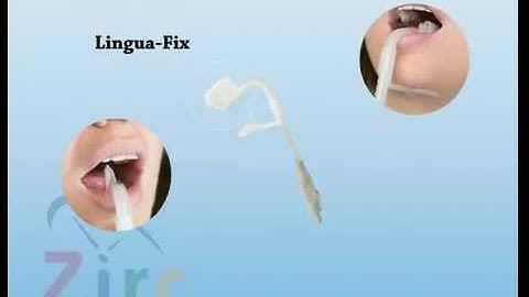 Zirc dental video on rubber dam, linguafix and se cushion