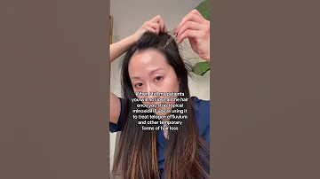 Hairloss Hairlosssolution Minoxidil Hairlosstreatment Dermatologist Haircare Hairthinning 