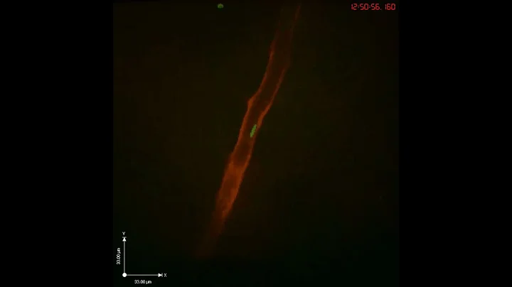 Borrelia burgdorferi interacting with blood vessels of the knee in a live mouse