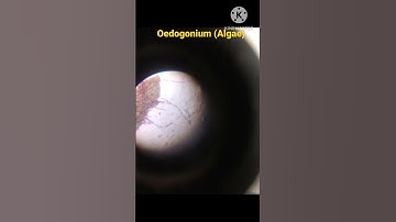 Microscopic view of Oedogonium (Algae)