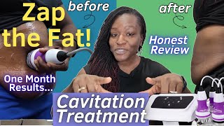 MYCHWAY WL-UU551 美顔器 40k 3 in 1 Cavitation Machine for Body Slimming Skin Tightening