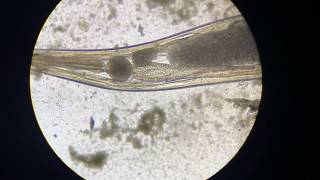 Pin Worm Egg Hatching